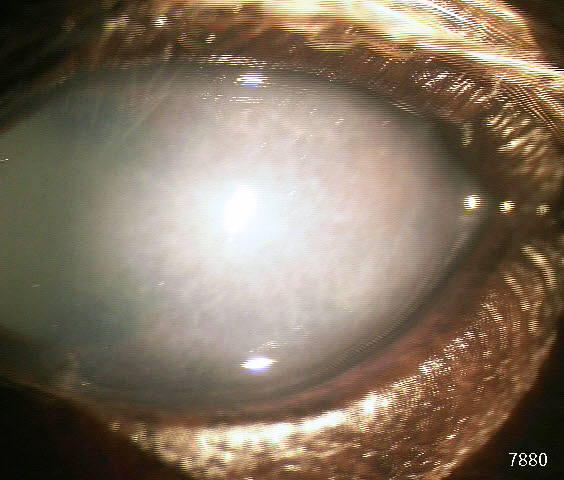 左目の角膜浮腫