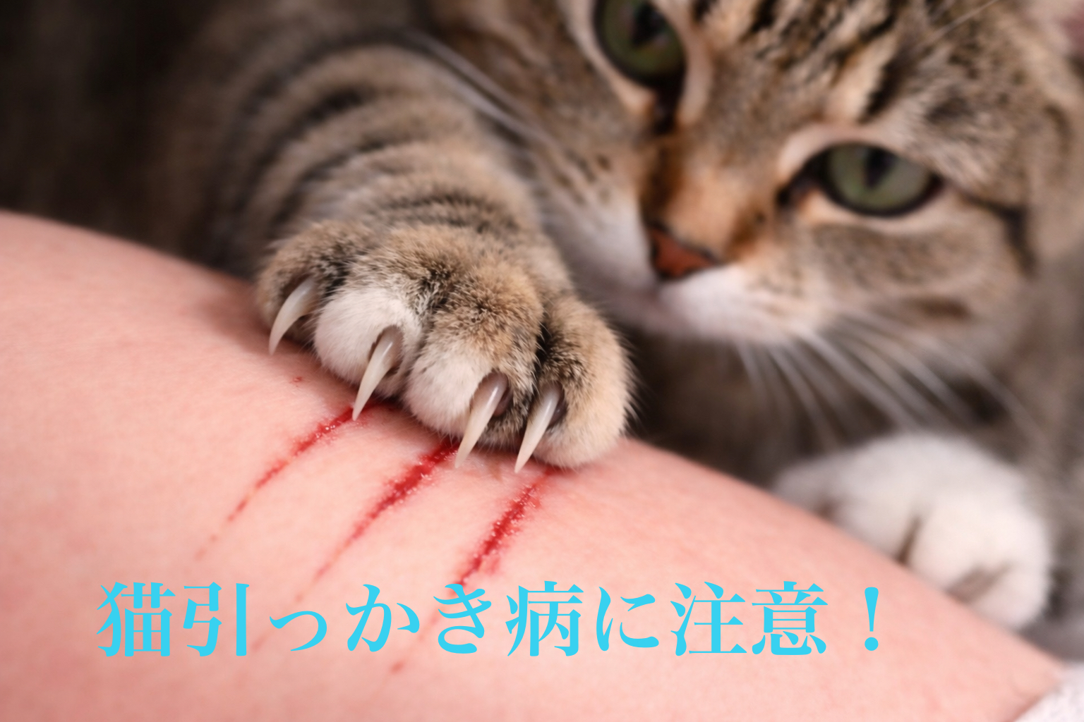 猫 ひっかき 病