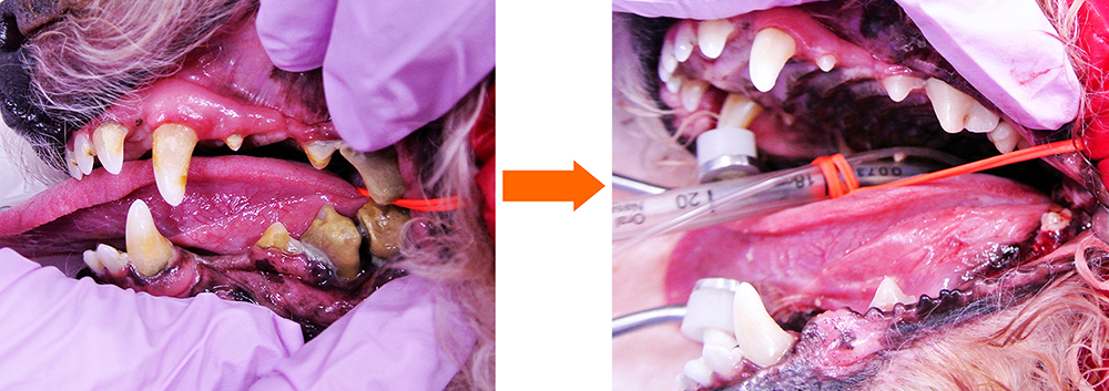 スケーリング（歯石除去）処置の前後の比較（とてもきれいな口腔内環境に戻ります）