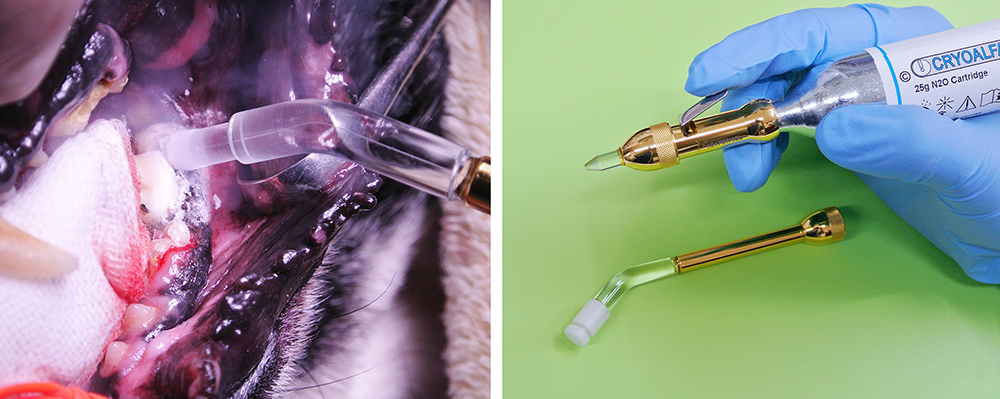 なぜ冷凍手術が行われるのか